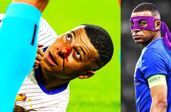 MBAPPE will MISS OUT ON THE REST OF THE EUROS!? The shocking truth about Kylian's injury!